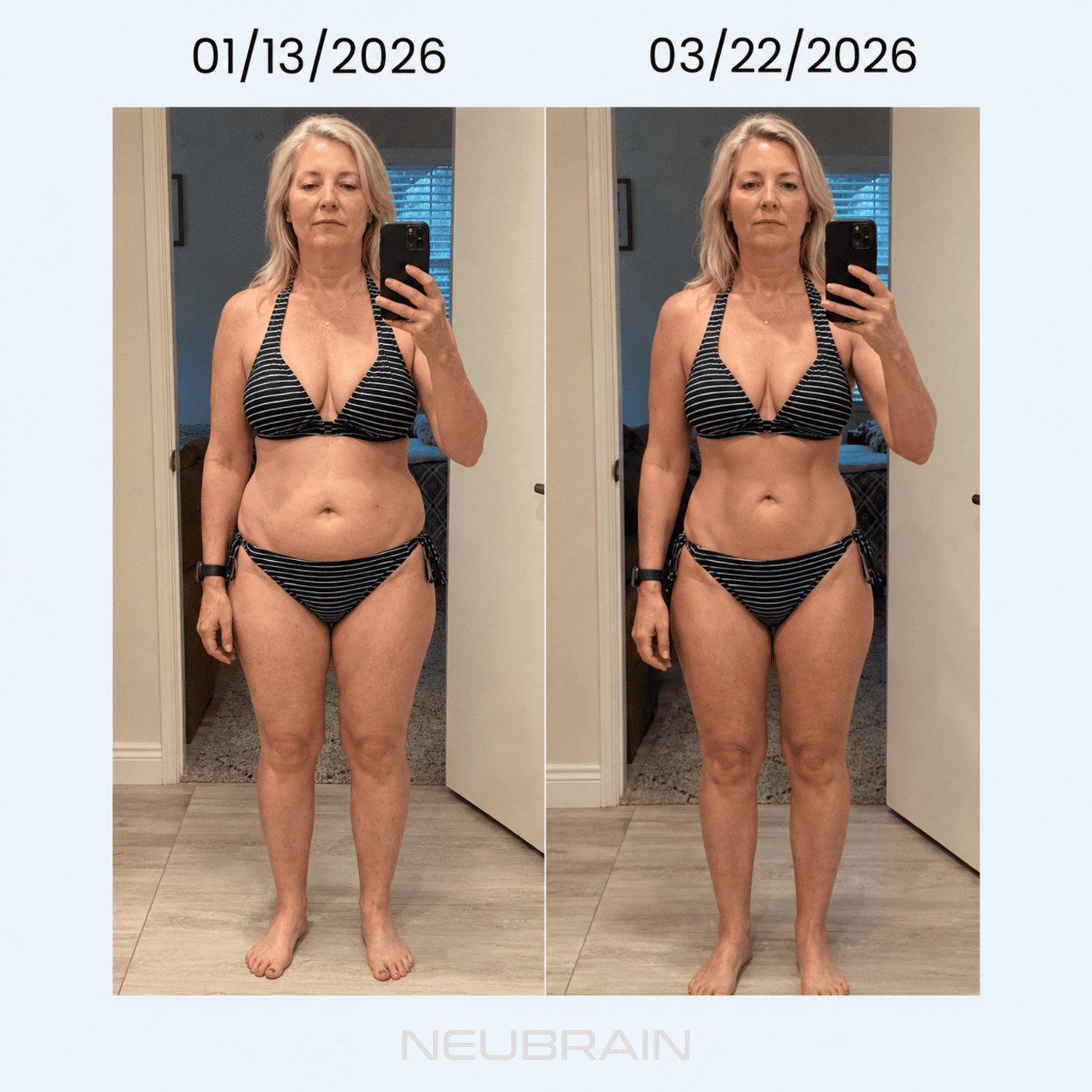 Dated before-and-after from a NEUBRAIN customer